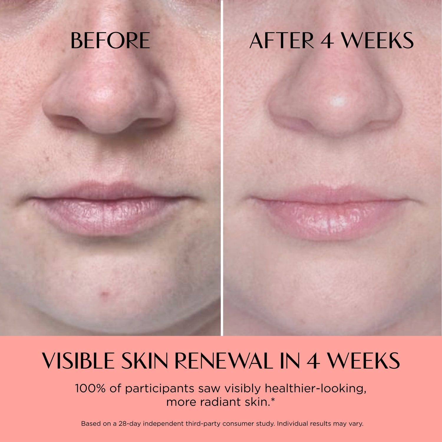 Before and after comparison of skin renewal with visible improvement after 4 weeks.