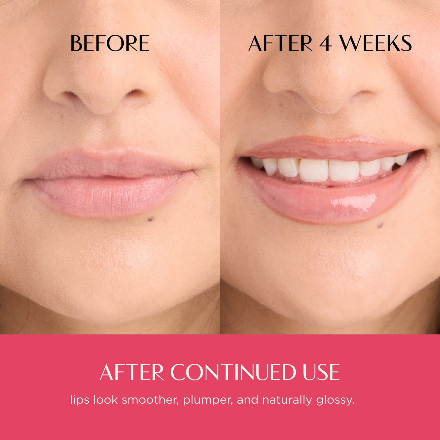 Before and after comparison of lips with text indicating improvement after 4 weeks of continued use.