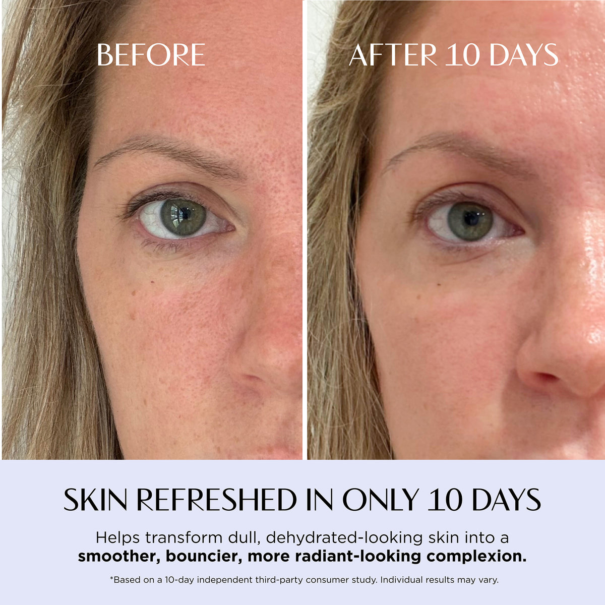 Before-and-after split screen comparison of a woman's face, focusing on her eye and cheek area, with text reading 'BEFORE' and 'AFTER 10 DAYS' and a claim at the bottom about refreshed skin in 10 days.