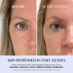 Before-and-after split screen comparison of a woman's face, focusing on her eye and cheek area, with text reading 'BEFORE' and 'AFTER 10 DAYS' and a claim at the bottom about refreshed skin in 10 days.