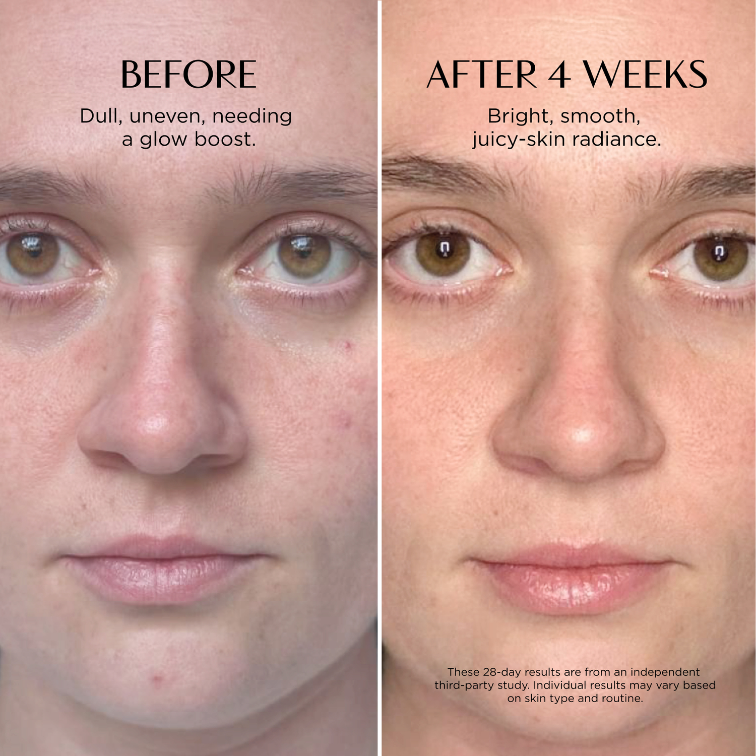 Before and after comparison of a person's face with text indicating improvement over 4 weeks.