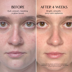 Before and after comparison of a person's face with text indicating improvement over 4 weeks.
