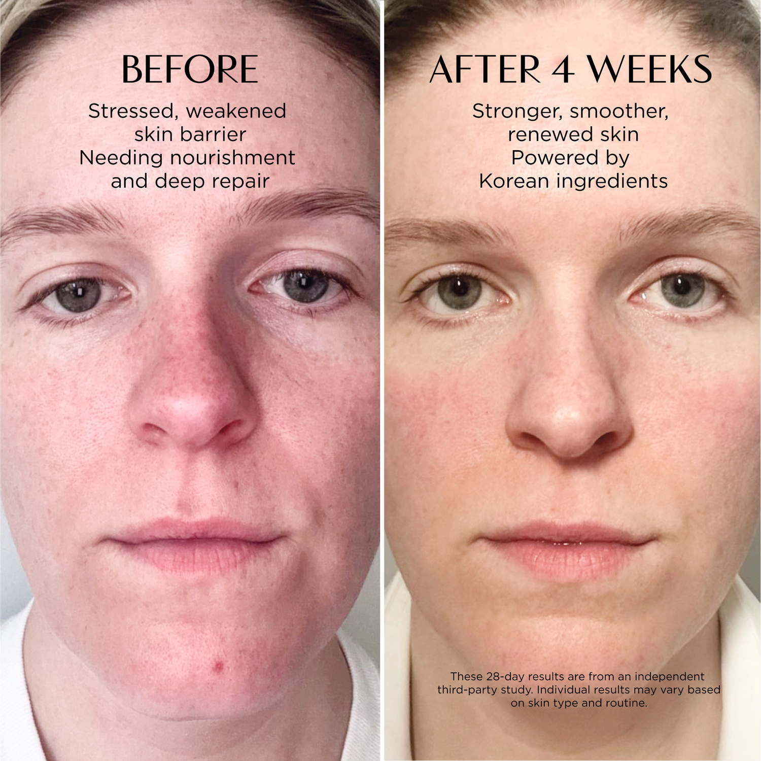 Before and after comparison of a person's face with text indicating improved skin condition.