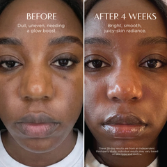 Before and after comparison of a woman's face with text indicating improvement over 4 weeks.