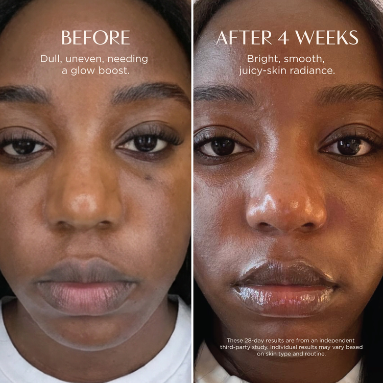 Before and after comparison of a woman's face with text indicating improvement over 4 weeks.