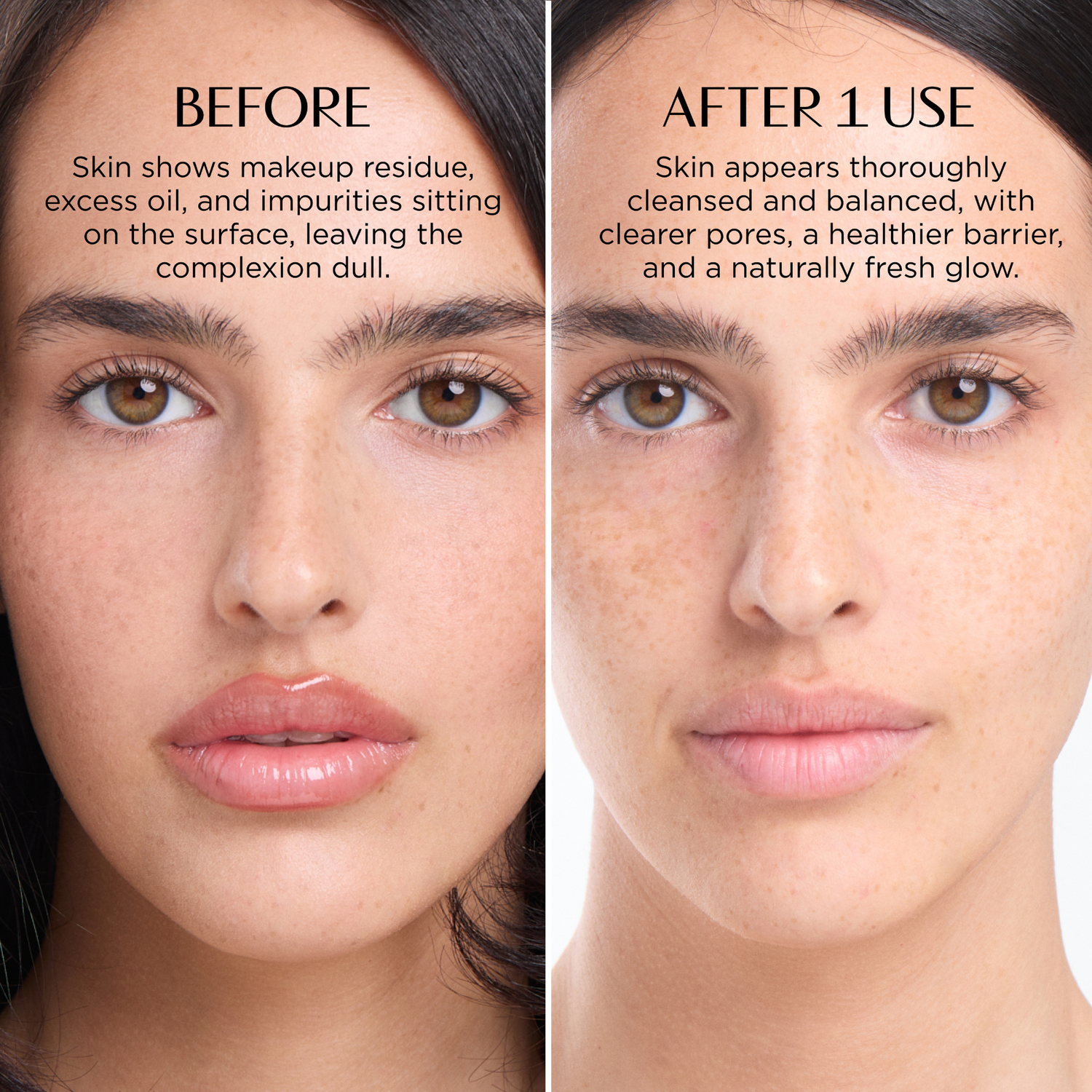 Before and after comparison of a woman's face with text describing the difference in skin condition.