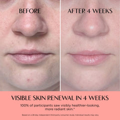 Before and after comparison of skin renewal with visible improvement after 4 weeks.