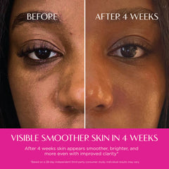Before and after comparison of skin smoothness with text indicating improvement in 4 weeks.