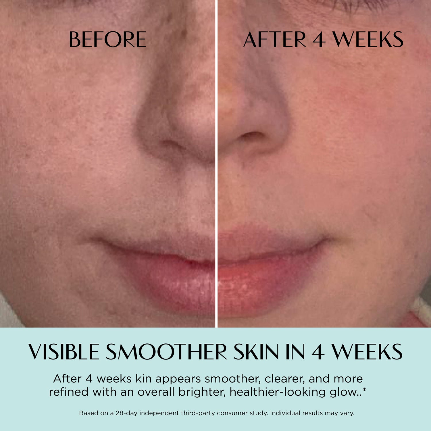 Before and after comparison of skin smoother treatment showing visible improvement.
