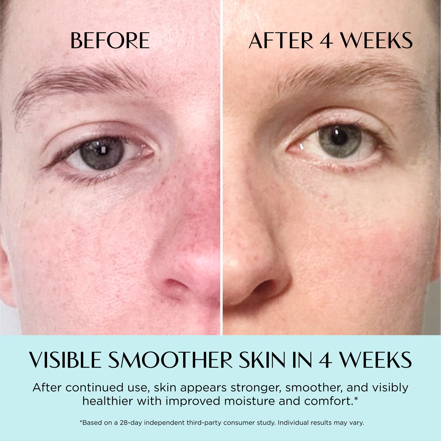 Before and after comparison of skin with text indicating visible smoother skin in 4 weeks.