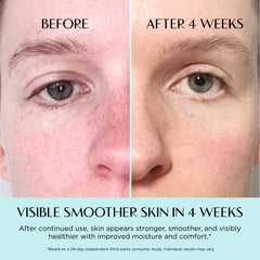 Before and after comparison of skin with text indicating visible smoother skin in 4 weeks.