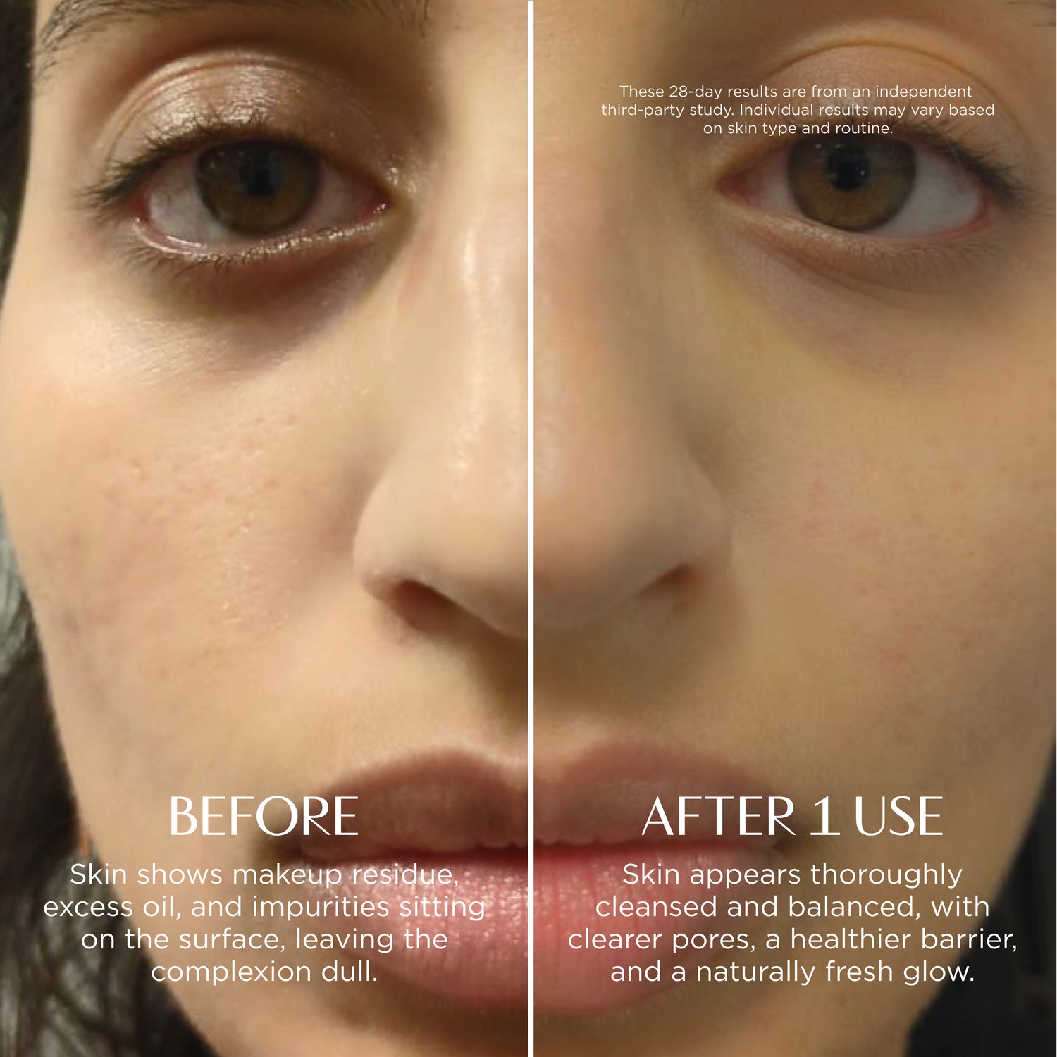 Before and after comparison of a woman's eye area with text on skin care results.