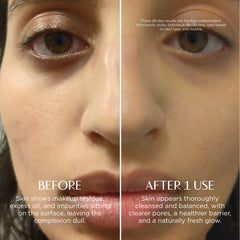Before and after comparison of a woman's eye area with text on skin care results.